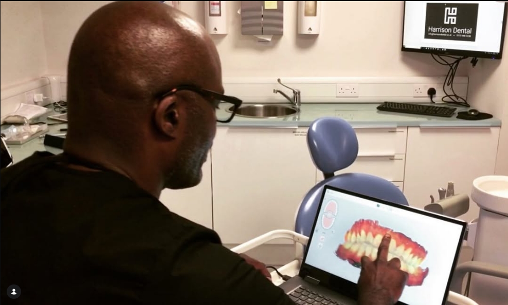iTero digital scanner in use at Harrison Dental